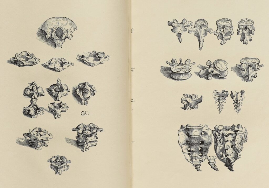 bones