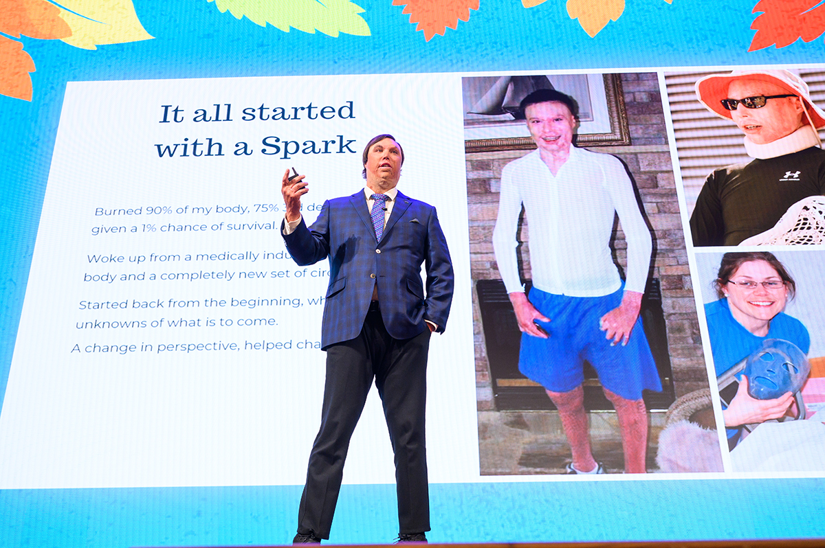 HPU Class of 2017 alumnus Connor McKemey, a motivational speaker, mentor and coach openly shared his gratitude gained from surviving a life-threatening burn.